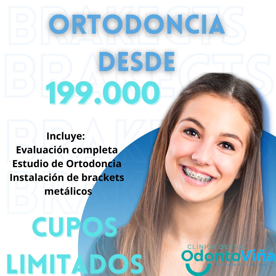 Ortodoncia desde 199.000 en Viña del Mar
